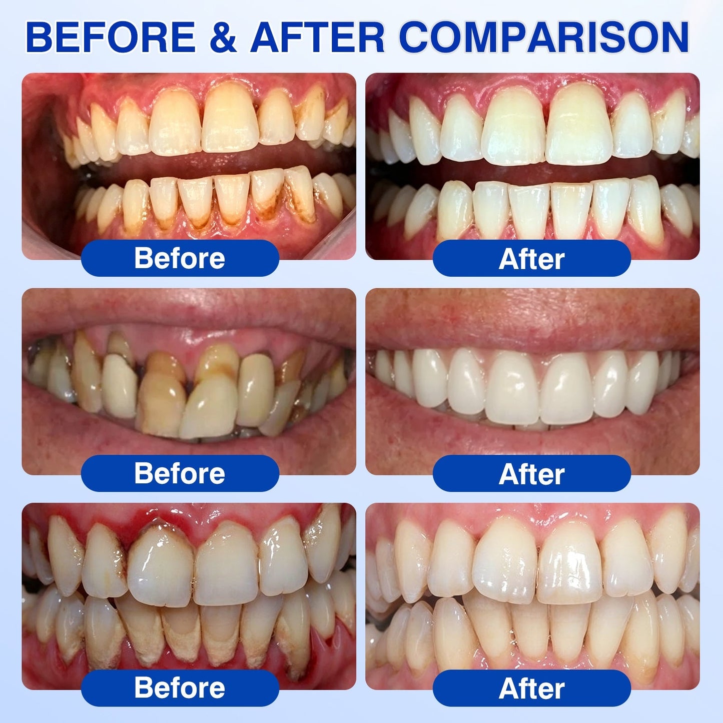 🇳🇿👨‍⚕️🦷🎉 CureVivo® GumRevive Periodontal Repair Gel🔥