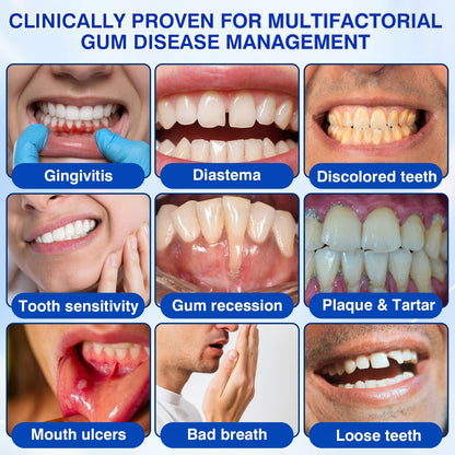 🇳🇿👨‍⚕️🦷🎉 CureVivo® GumRevive Periodontal Repair Gel🔥