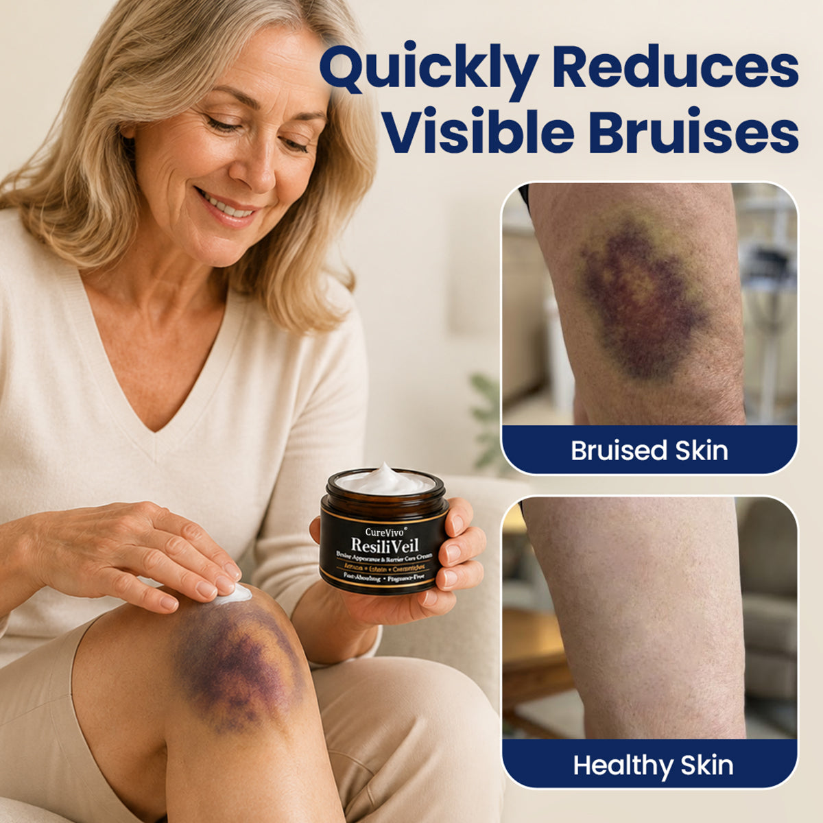 CureVivo® ResiliVeil Bruise Appearance Barrier Care Cream 🔥👍