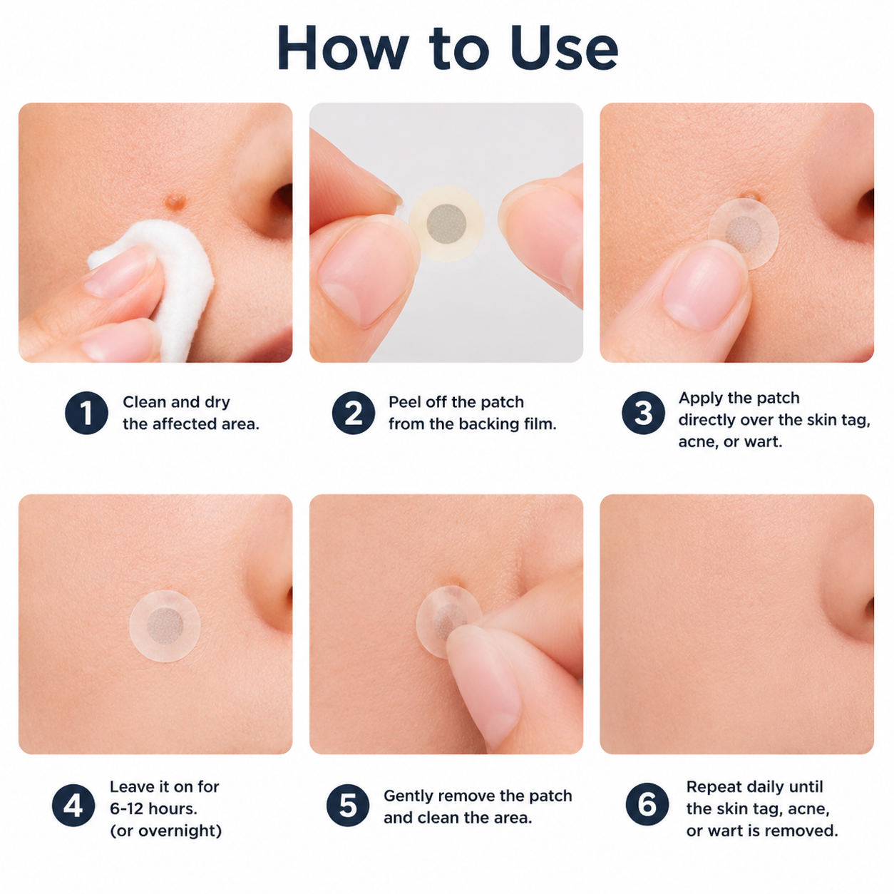 🇳🇿✅𝐇𝐞𝒂𝒍𝗿𝗶𝙯𝙚®2-in-1 Microneedle & Hydrocolloid Patch🎉| Removes Raised Moles, Acne, Flat Warts & Skin Tags | Helps Improve Wrinkles, Scars & Blemishes | Invisible Patches for Face & Body