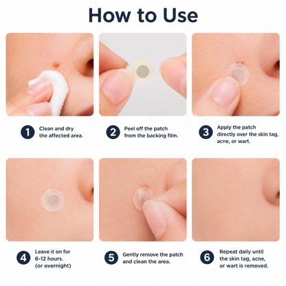🇳🇿✅𝐇𝐞𝒂𝒍𝗿𝗶𝙯𝙚®2-in-1 Microneedle & Hydrocolloid Patch🎉| Removes Raised Moles, Acne, Flat Warts & Skin Tags | Helps Improve Wrinkles, Scars & Blemishes | Invisible Patches for Face & Body
